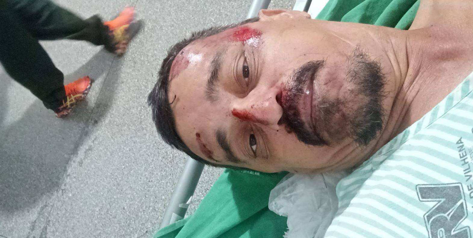 Vítima da imprudência de motociclista que fugiu da PRF por estar pilotando de chinelos em rodovia fala ao FOLHA DO SUL