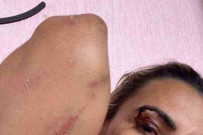 Após nova agressão do marido, que ameaçou matá-la, mulher registra queixa na polícia e pede medida protetiva