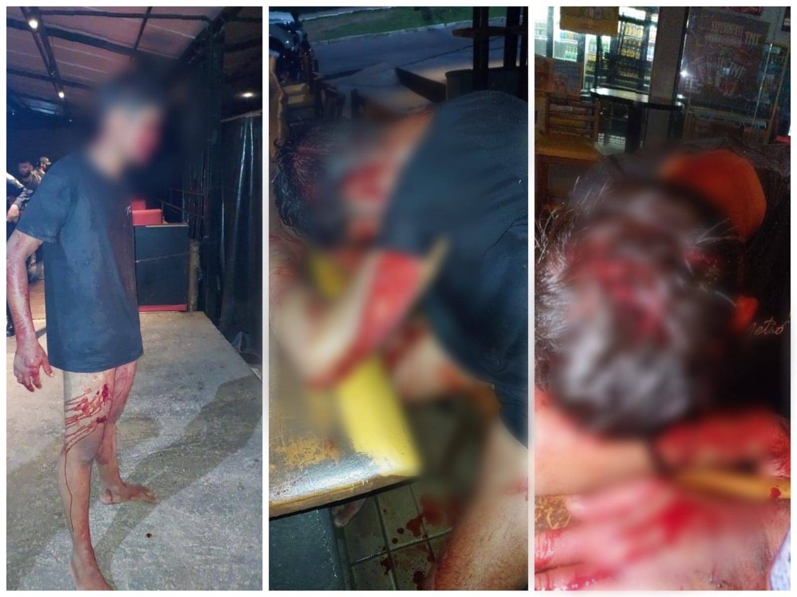 Homem é ferido a golpes de facão a caminho de casa em Cacoal; os suspeitos não foram localizados