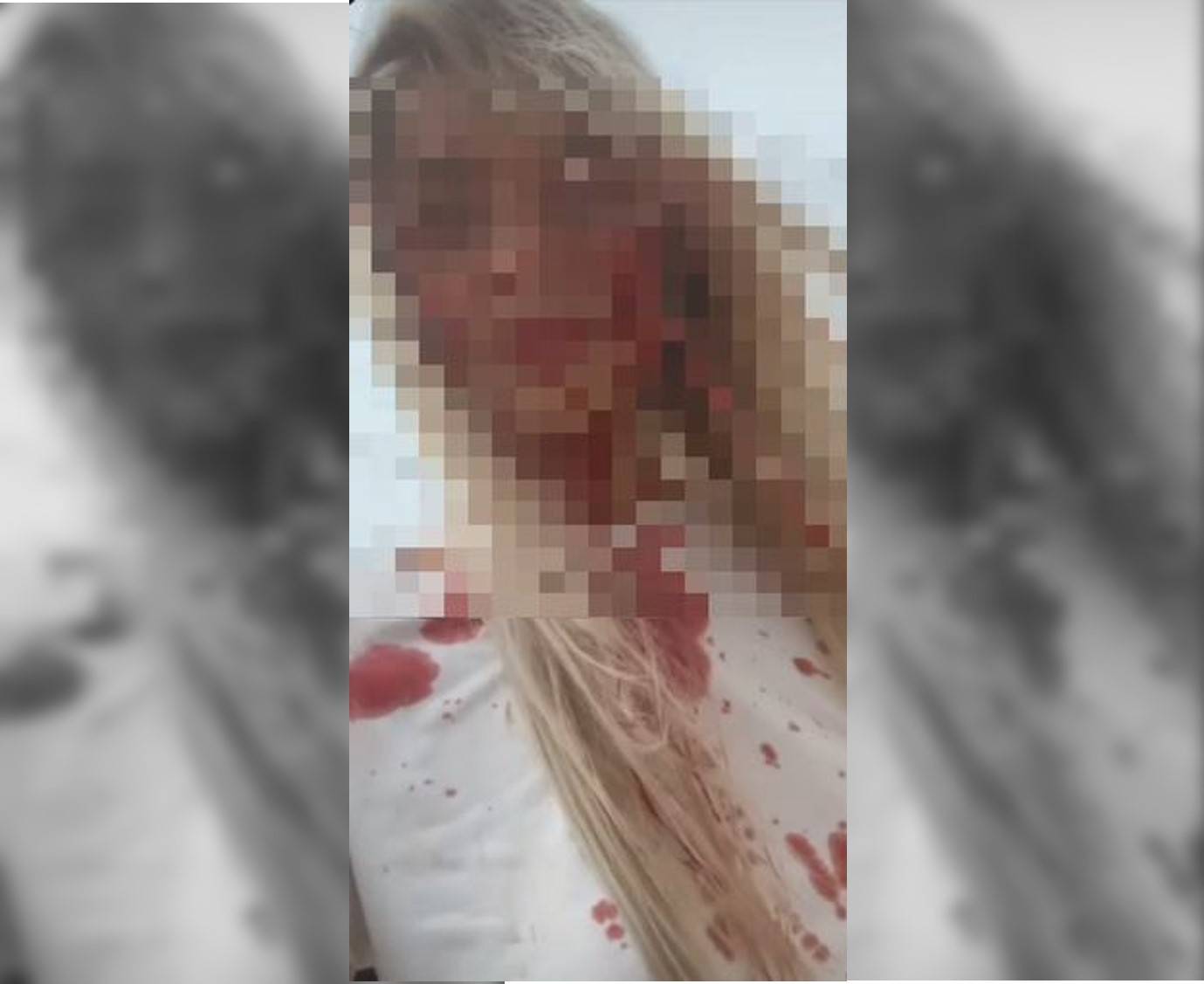Cabeleira vilhenense expõe em rede social agressões que sofreu do ex e alerta para feminicídio