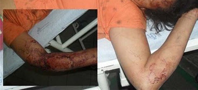 Mulher é esfaqueada por companheiro e menino de 6 anos vê tudo