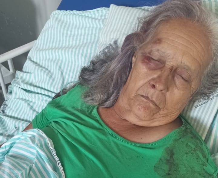 Idosa de Corumbiara que sofreu acidente de moto junto com o marido em rodovia do Cone Sul segue internada em hospital de Vilhena