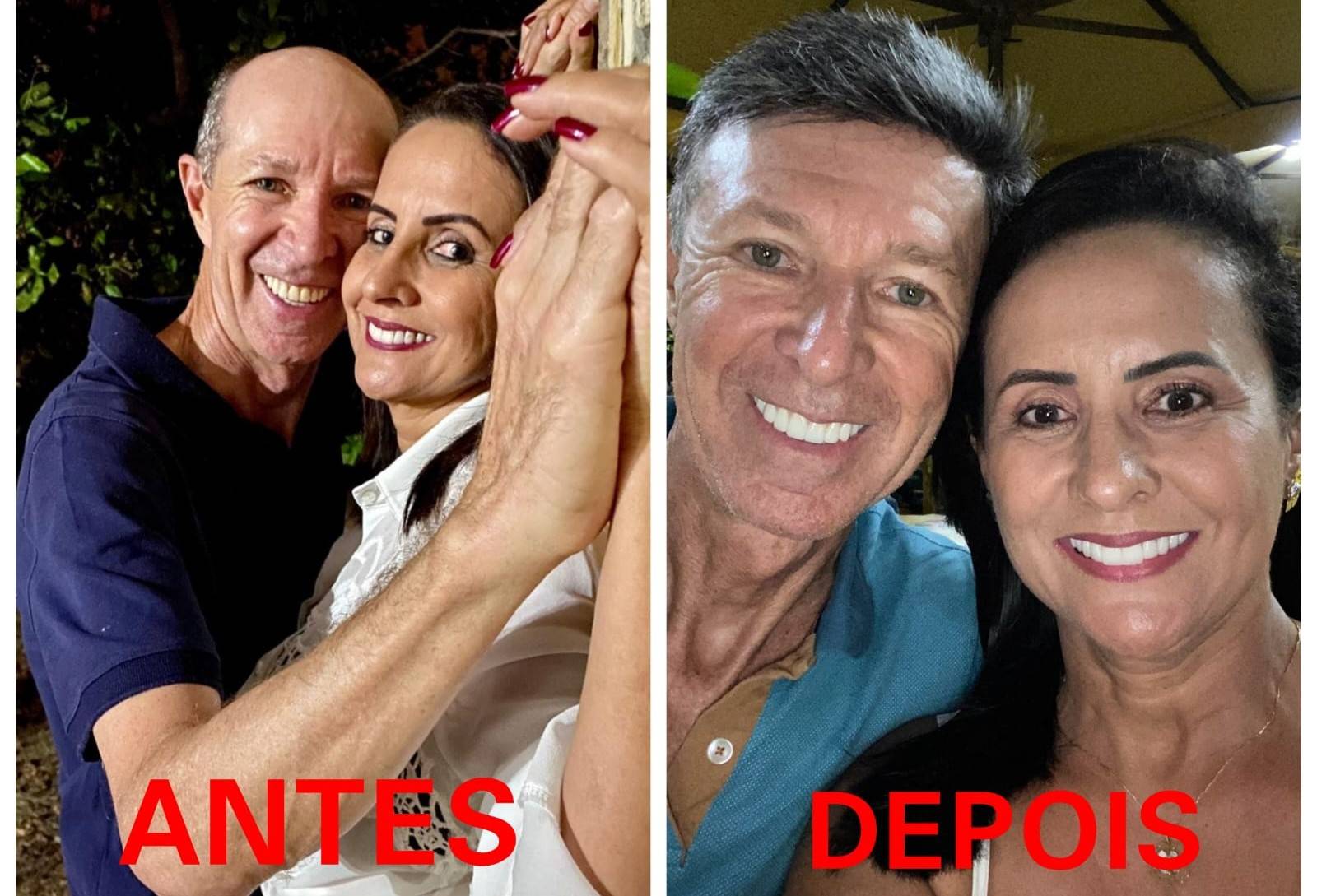 Ex-vereador que se alterna entre Vilhena e praia do Nordeste adota novo estilo capilar e chama atenção nas redes sociais