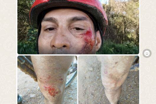 Ciclista derrubado por carreta em rodovia do Cone Sul mostra o risco de “Pedal” em BRs; morte de mulher traumatizou atletas de Vilhena