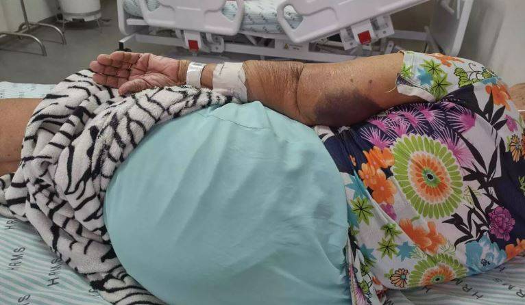 OBRA DO CÃO: atacada por cachorro do vizinho, mulher de 79 anos sofre queda e vai parar no hospital, em Vilhena