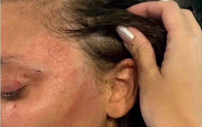 Após provocar parceira com “garotas do job”, homem desfere soco no rosto dela e casal vai parar na polícia, em Vilhena