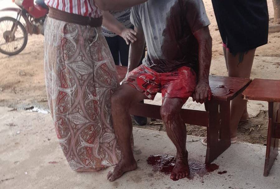 Após atingir outro com cinco facadas em Pimenteiras do Oeste, homem reage a prisão e toma três tiros de bala de borracha