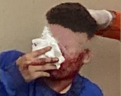 Rapaz que foi baleado no rosto pelo próprio comparsa é condenado pelo assassinato de homem de 46 anos, em Vilhena