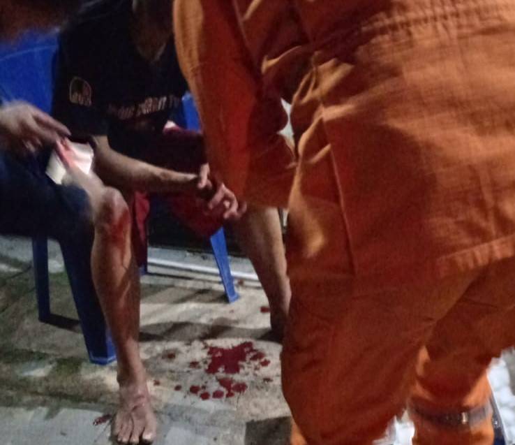 Adolescente de 17 anos é baleado no rosto e socorrido por Bombeiros em Cerejeiras; garoto diz ter sido vítima de emboscada