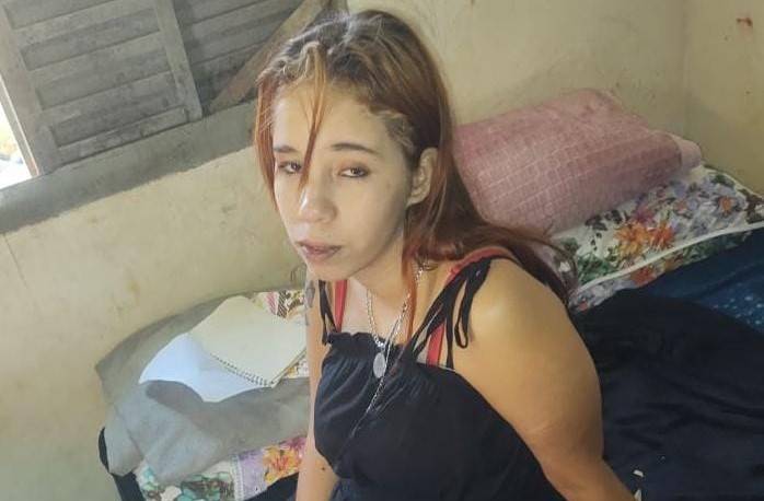 COMOVENTE: saiba como ajudar a jovem de 21 anos que perdeu o marido em acidente de trânsito e precisou amputar a perna, em Vilhena