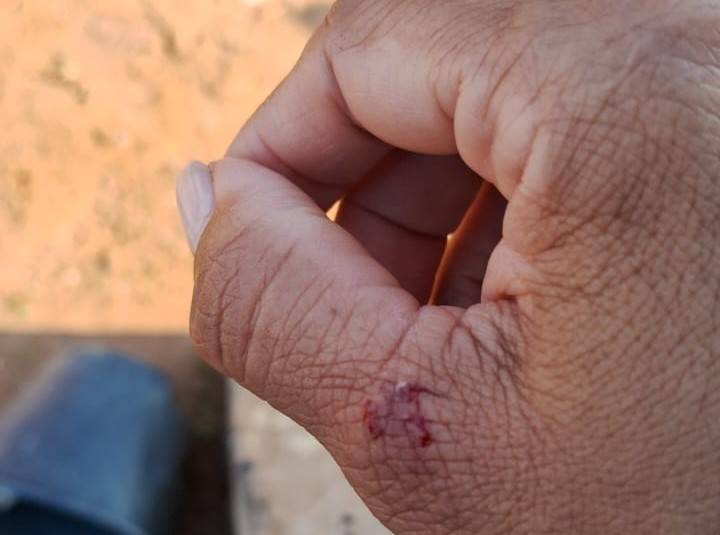 FOLHA DO SUL entrevista leiturista do SAAE atacada por cachorro no mesmo bairro pela segunda vez, em Vilhena, e ela faz revelação chocante