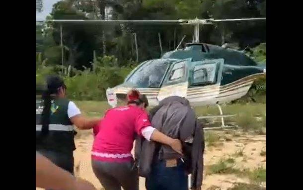 VÍDEO E FOTOS IMPRESSIONANTES: viralizam imagens de cacique que ficou “esfolado” após ataque de onça em Estado vizinho
