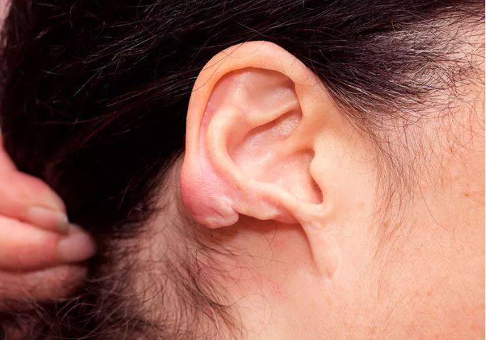 Em briga com o namorado, garota de 23 anos tem parte da orelha arrancada a dentadas e vai parar no hospital, em Vilhena