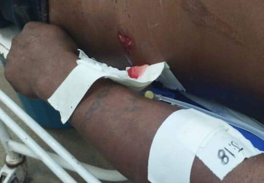 IMAGENS FORTÍSSIMAS: vídeos mostram resgate do corpo de rondoniense morto por indígenas no Amazonas; PF vai investigar o crime
