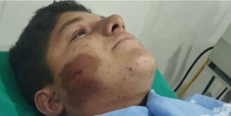 VÍDEO: “vaquinha” é criada para ajudar adolescente que perdeu dois irmãos em acidente na BR 364 e agora luta para não ficar paraplégico