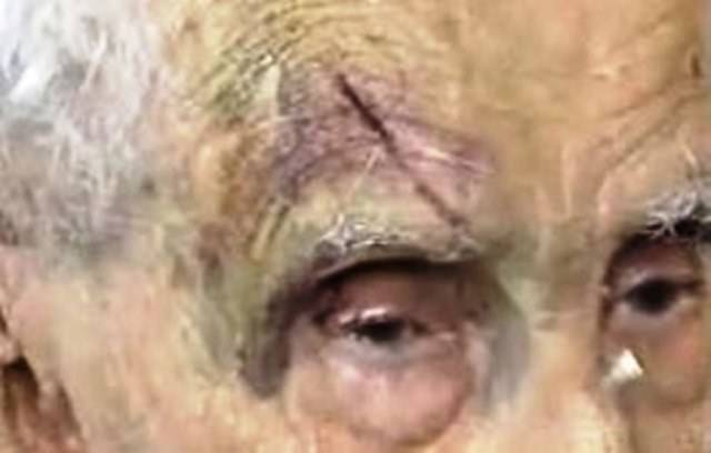 Sujeito é detido por tentativa de furto e idoso leva coronhada de ladrões