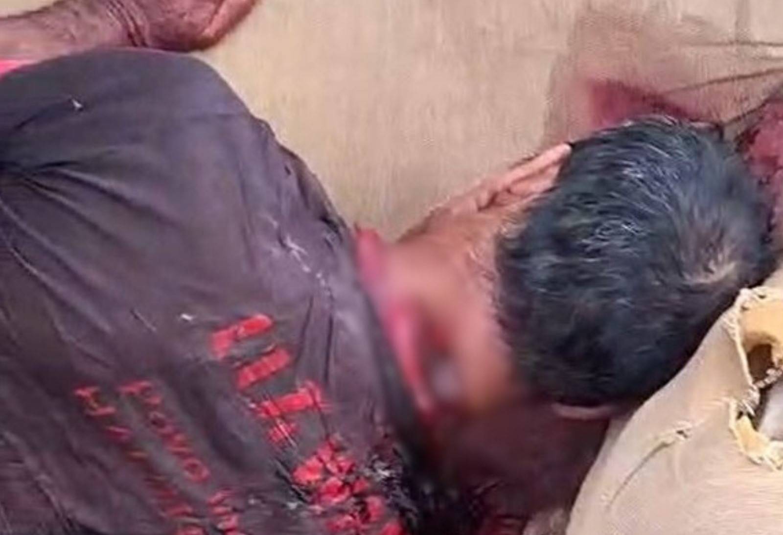 VÍDEO IMPACTANTE: homem encontrado com profundo corte no pescoço em frente a UPA, em Vilhena, é resgatado e passa por cirurgia