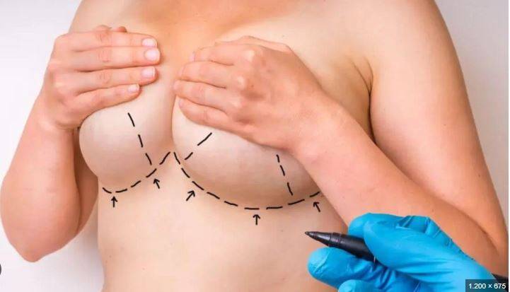 Chamado de “corno” por médico-BBB de MT, vilhenense que teve esposa operada pelo cirurgião vai à justiça e pede indenização