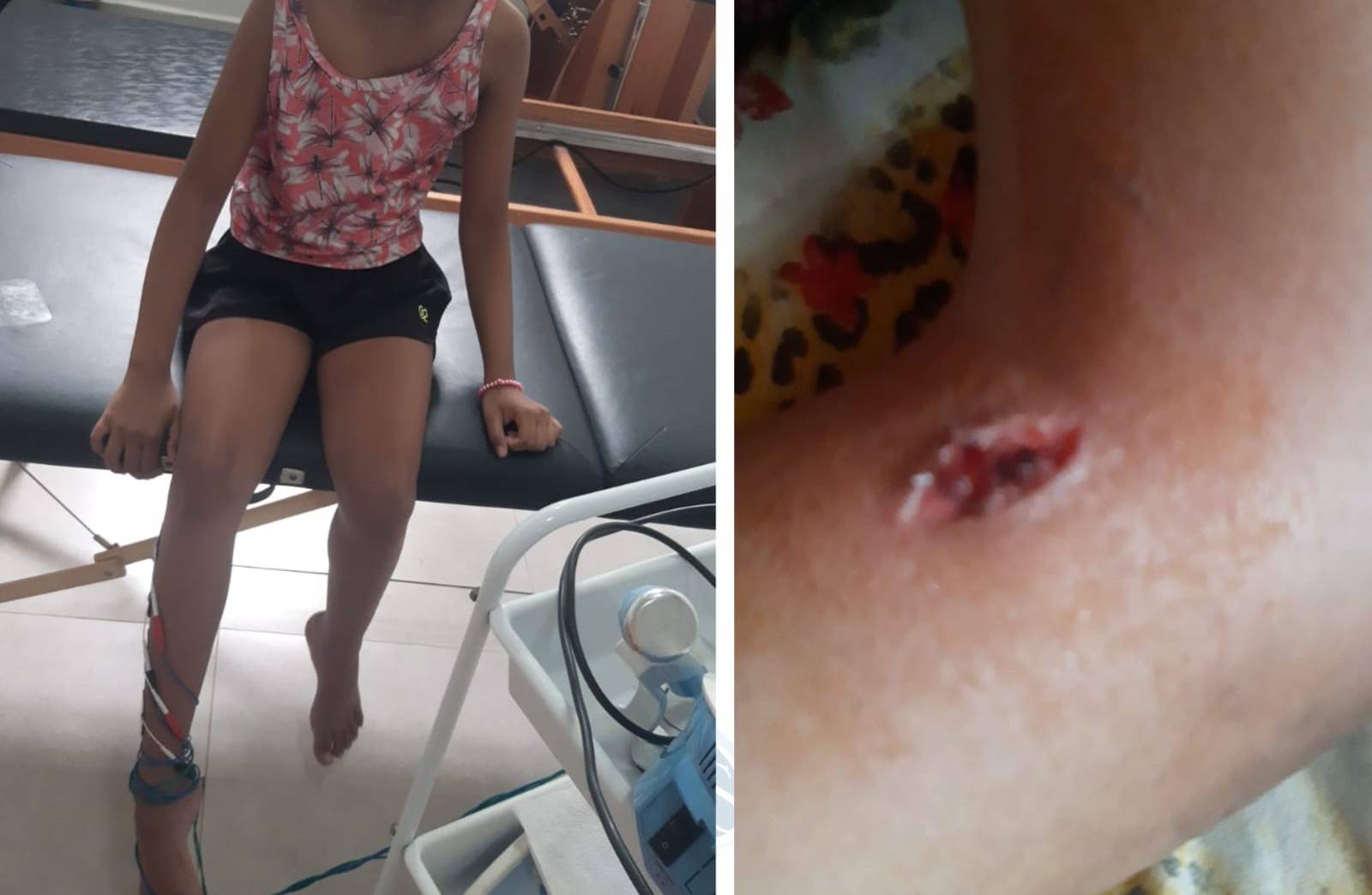 Com a filha na fila do SUS há dois anos esperando por cirurgia, mãe pede ajuda para realizar procedimento na rede particular