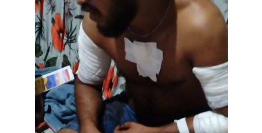 ASSISTA VÍDEO: homem sobrevive a 7 facadas desferidas pela própria esposa em distrito a 90 km da área urbana de Vilhena