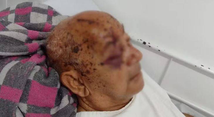 Após agredir o próprio pai idoso em área rural de Vilhena, homem foge pulando cercas com medo da PM