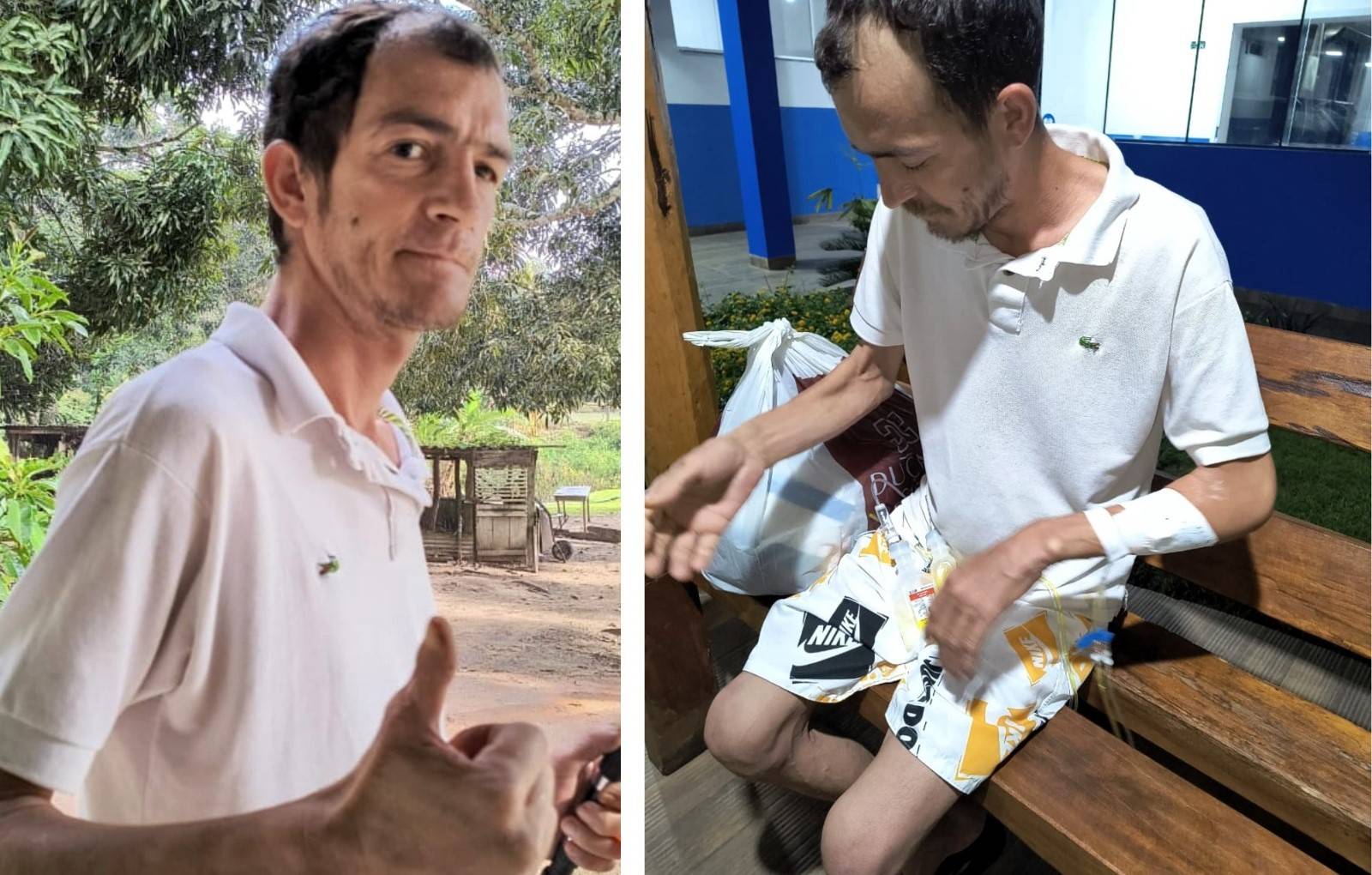 COMOVENTE: com doenças crônicas, pintor não consegue trabalhar e vive situação dramática junto com a mãe, em Vilhena