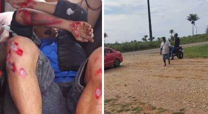 Uma semana após buraqueira provocar morte na BR 435, em Colorado do Oeste, motociclista bate em cratera e fica “todo ralado”