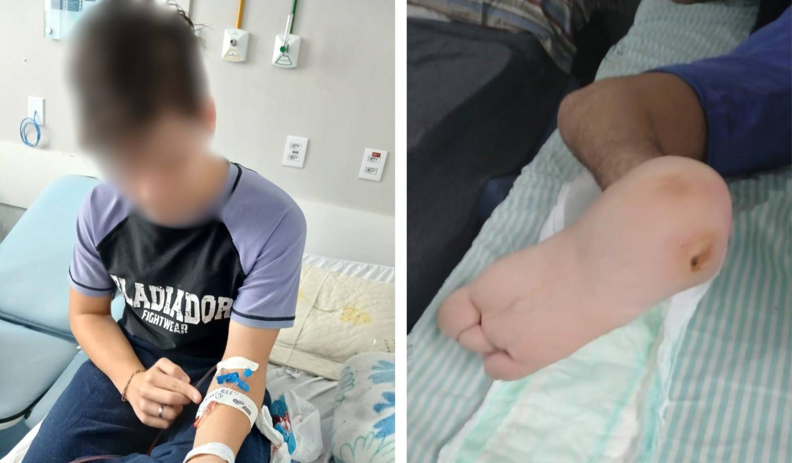 Família de Vilhena vive drama com garoto internado por infecção óssea grave; pai do menino precisou amputar a perna