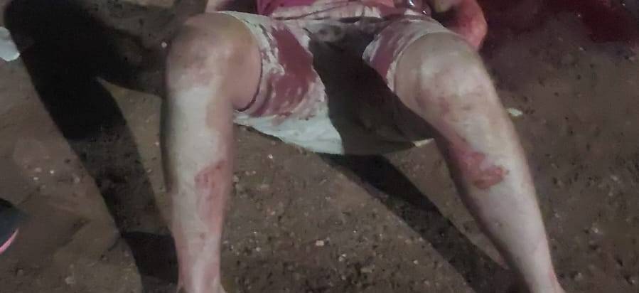 Homem fica com as vísceras expostas após ser esfaqueado no pátio de posto de combustíveis, em Vilhena