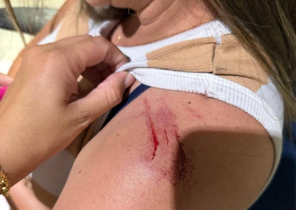 FOTOS E VÍDEOS: Mulher é espancada pelo ex-marido que tentava reconciliação em Colorado do Oeste; homem não ficou preso