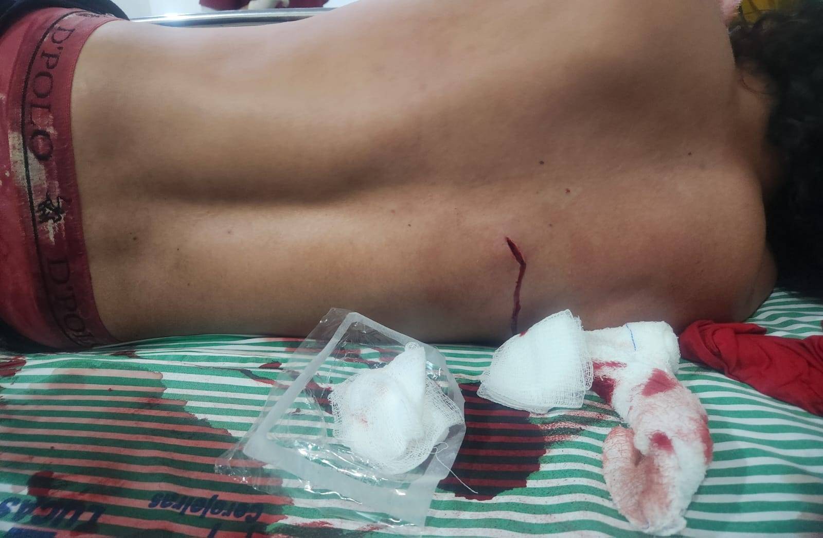 Violência em Cerejeiras: tentativa de homicídio a facadas agita a madrugada no centro da cidade