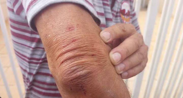 Idosa é atacada por ladrão na rua e fica sem a bolsa com documentos, em Vilhena; Polícia Militar é acionada