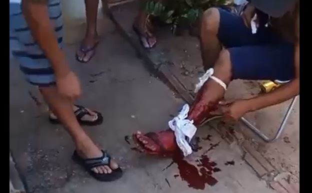 ASSISTA VÍDEO: dois homens em motocicleta abrem fogo contra morador de Chupinguaia; 18 disparos teriam sido feitos
