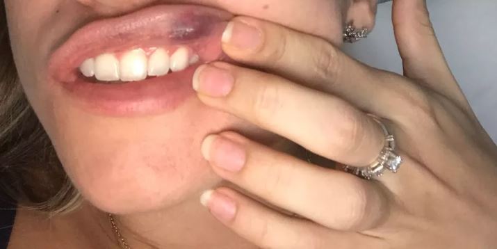 Polícia Militar é acionada após homem espancar a esposa e a própria irmã, na cidade de Cerejeiras