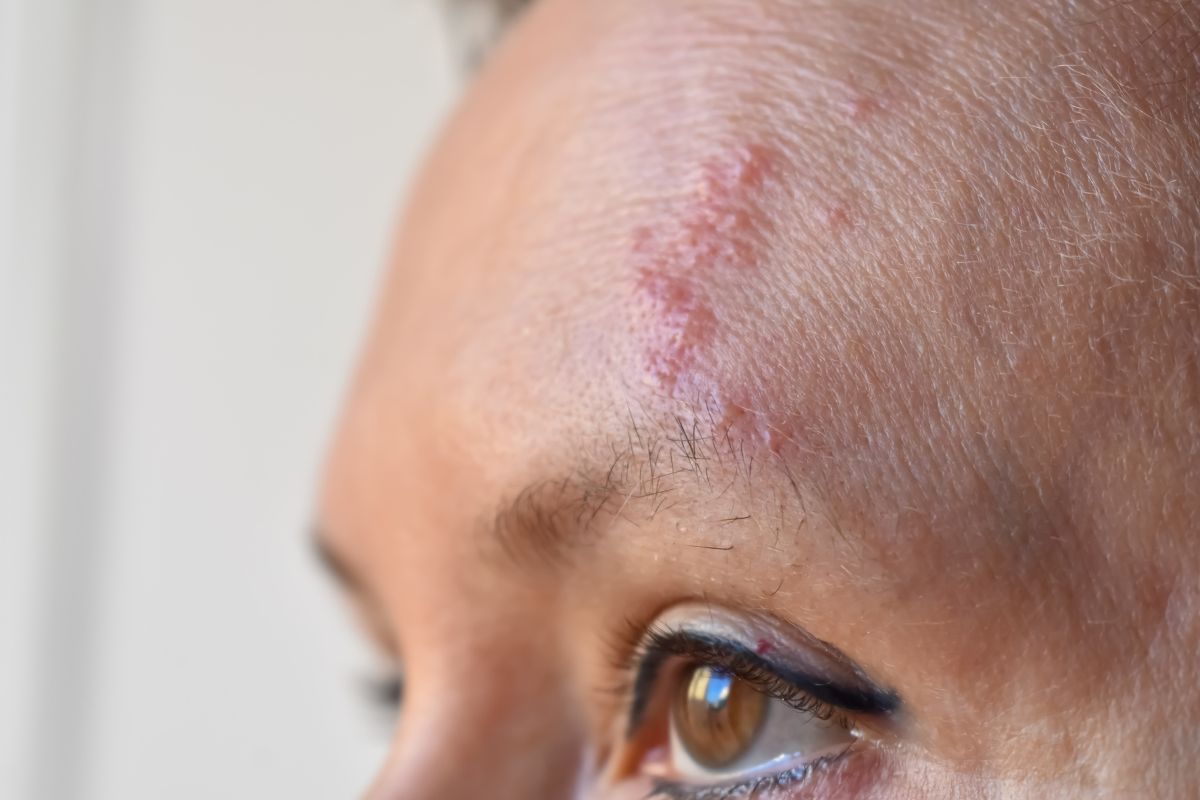Mulher diz ter sido espancada por professora de artes marciais e suas alunas durante churrasco, em Vilhena