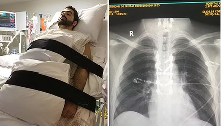 Paciente que perdeu movimento das pernas após acidente e se recuperou com tratamento experimental é a inspiração para vilhenense
