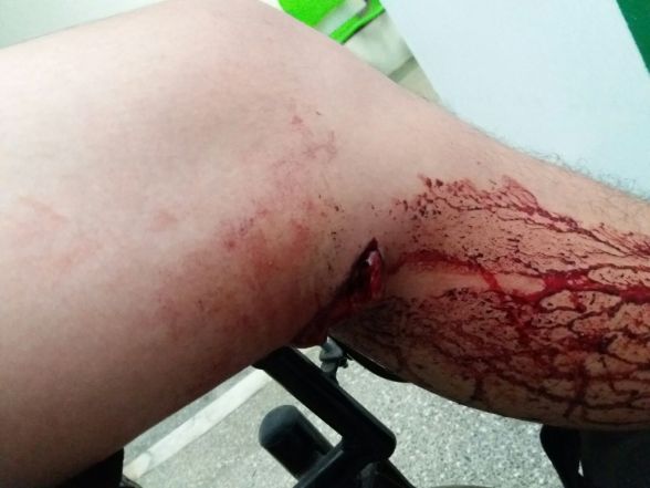 Rapaz de 25 anos sobrevive após ser baleado em praça considerada “cracolândia”, em Vilhena