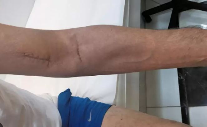 Discussão durante jogo de futebol acaba com rapaz de 19 anos esfaqueado por adolescente de 16, em Vilhena