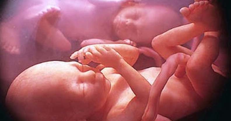 Morrem na barriga da mãe, um dia após o outro, as menininhas gêmeas que inspiraram campanha de ajuda, em Vilhena