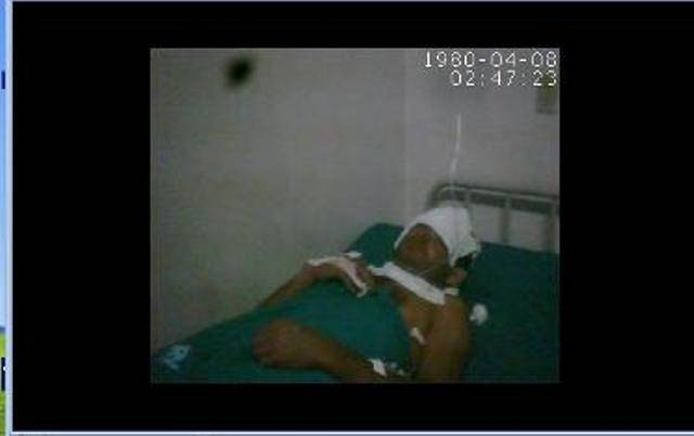 SURDO-MUDO ATEIA FOGO AO PRÓPRIO CORPO APÓS SER DEMITIDO