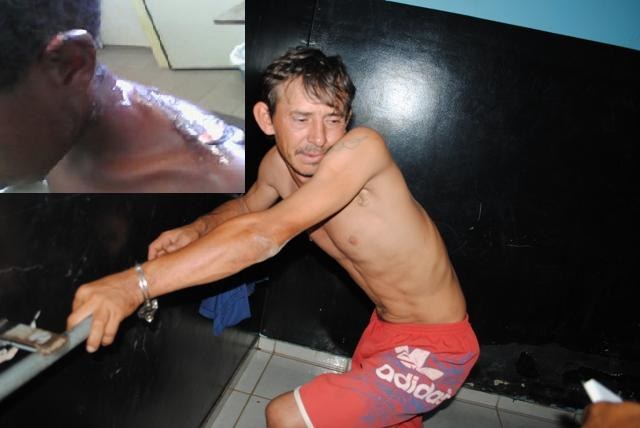 Padrasto é acusado de jogar água fervendo em enteado de 11 anos