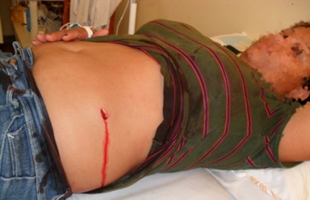 Mulher esfaqueia suposta amante do marido e é agredida pelo irmão da vítima