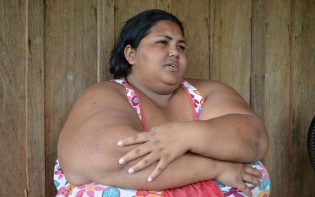Pesando 200 quilos, mulher pede ajuda para cirurgia de redução de estômago em RO