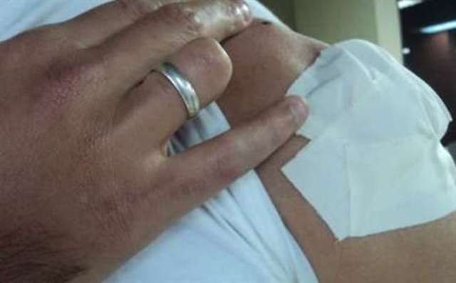 Homem ferido a bala durante conflito em fazenda continua internado em Vilhena