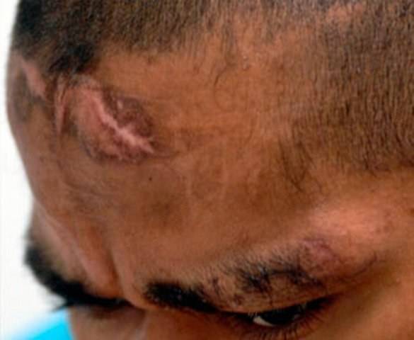 SERRADOR É AGREDIDO A PAULADAS PELO SOBRINHO