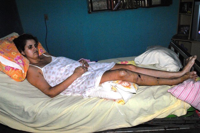 Servidora toma dinheiro emprestado e paga cirurgia para não ficar paraplégica