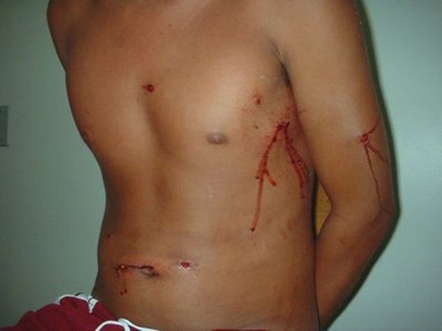 Policial feminina reage a roubo e atira contra bandidos em Vilhena: um baleado