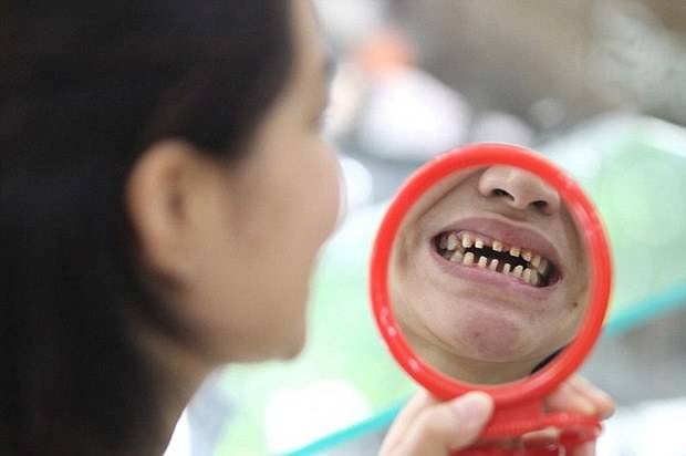 Mulher processa dentista que a deixou tão feia que assusta seu bebê