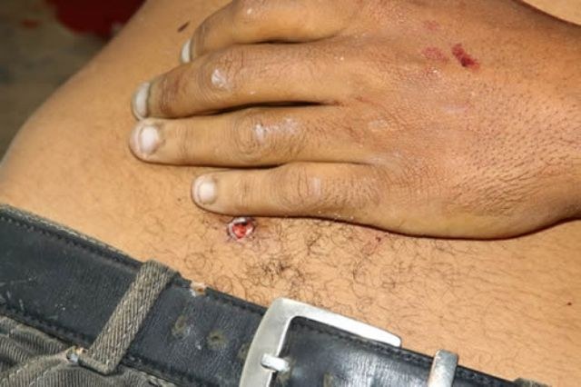 Acionada por populares, polícia encontra rapaz de 26 anos baleado em Vilhena
