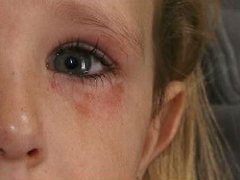 CRUELDADE  (1)